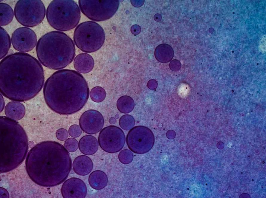 Biofilm And Human Health The Hidden Threat & How To Detect It